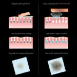 FAUSTINA RF | Radio Frequency Beauty Device - Image 6