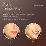 FAUSTINA 3IN1 IPL Device | Hair Removal, Skin Rejuvenation & Acne Clearance - Image 4