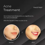 FAUSTINA Pro IPL Acne Clearance treatment with before and after example of acne-prone skin